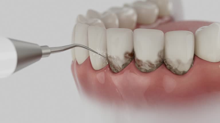 Trusted Dental Crowns And Bridges service in Homewood, AL - Dentist Open Now
